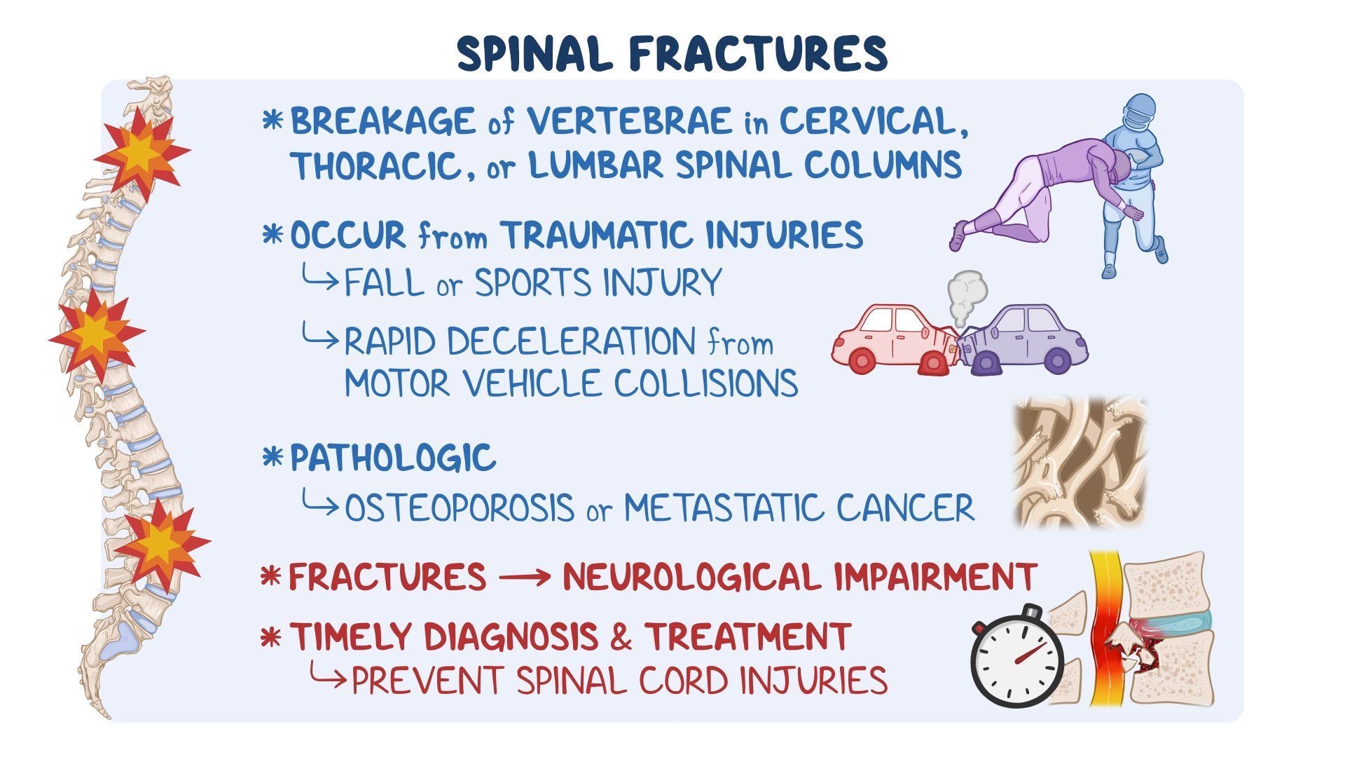 Spinal fractures: Video & Meaning | Osmosis