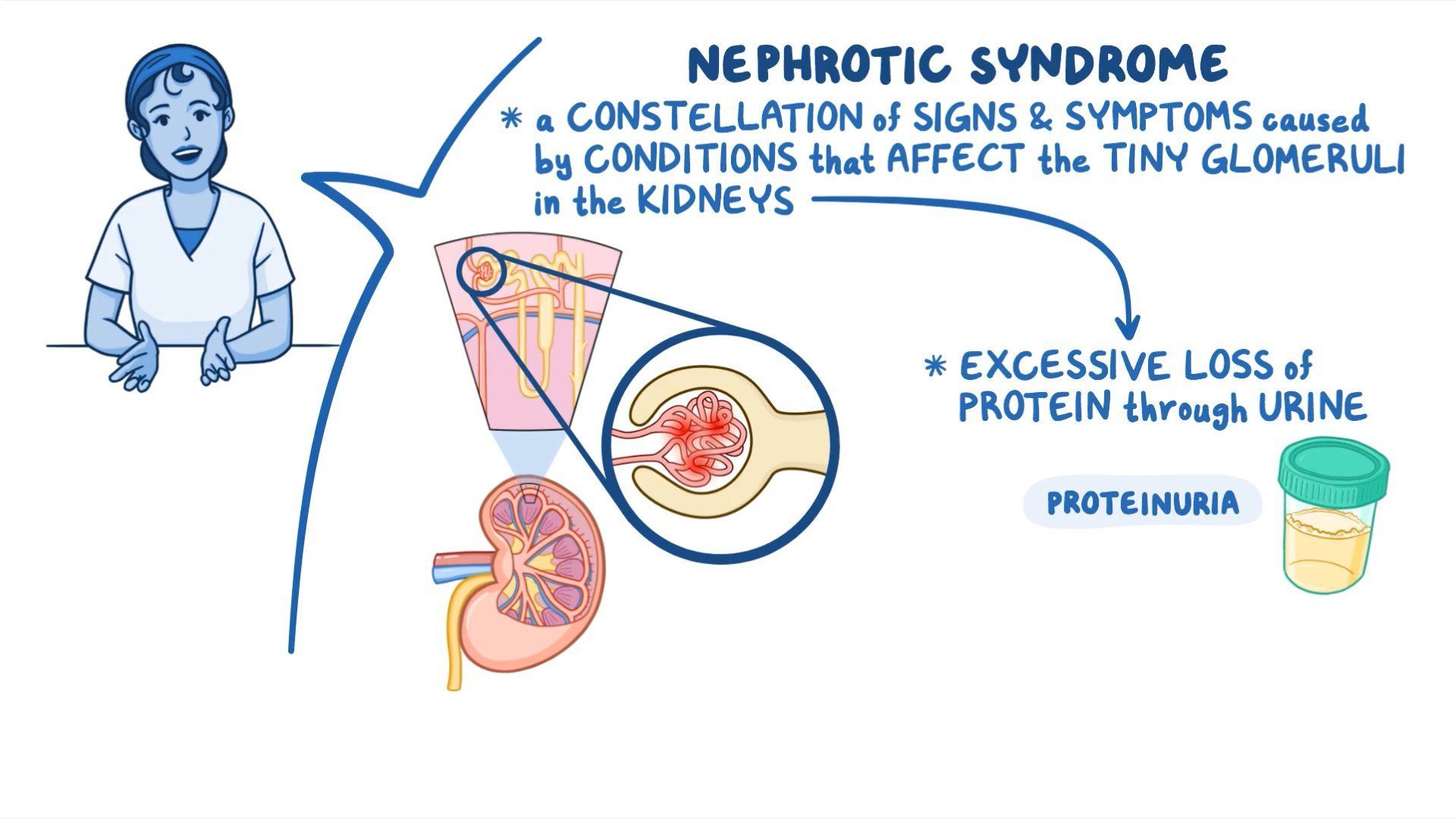 Nephrocity Periorbital Edema Nephrotic Syndrome