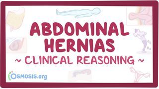 Video poster for Clinical Reasoning: Hernias