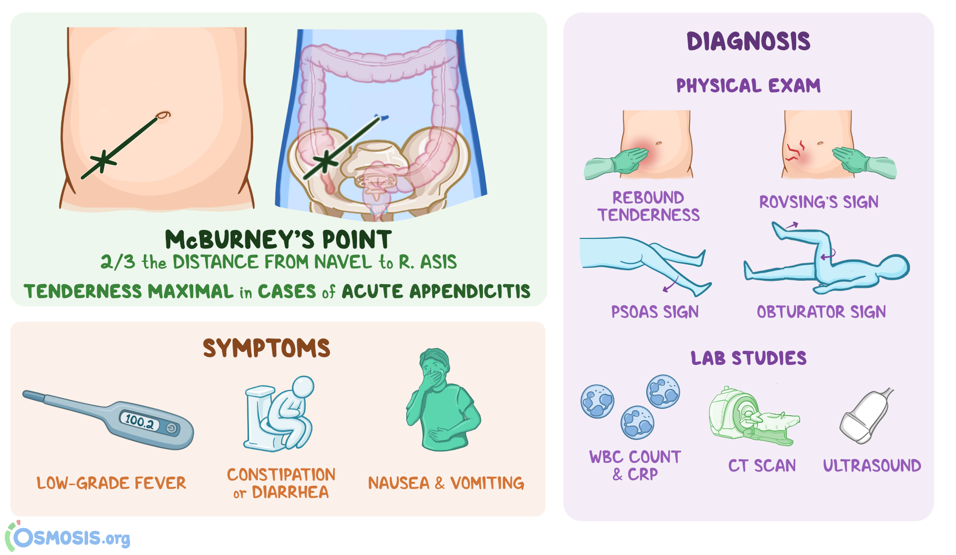Appendicitis Signs Symptoms And Treatment