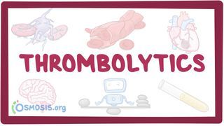 Video poster for Thrombolytics
