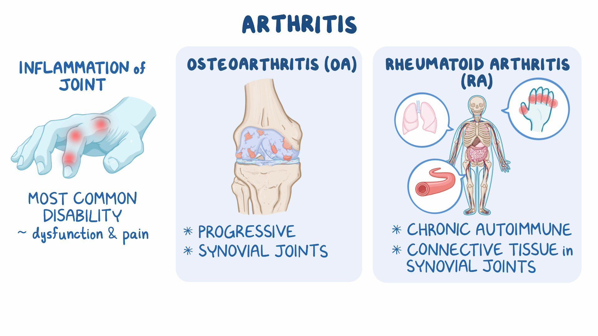 Video Nursing Care For Arthritis