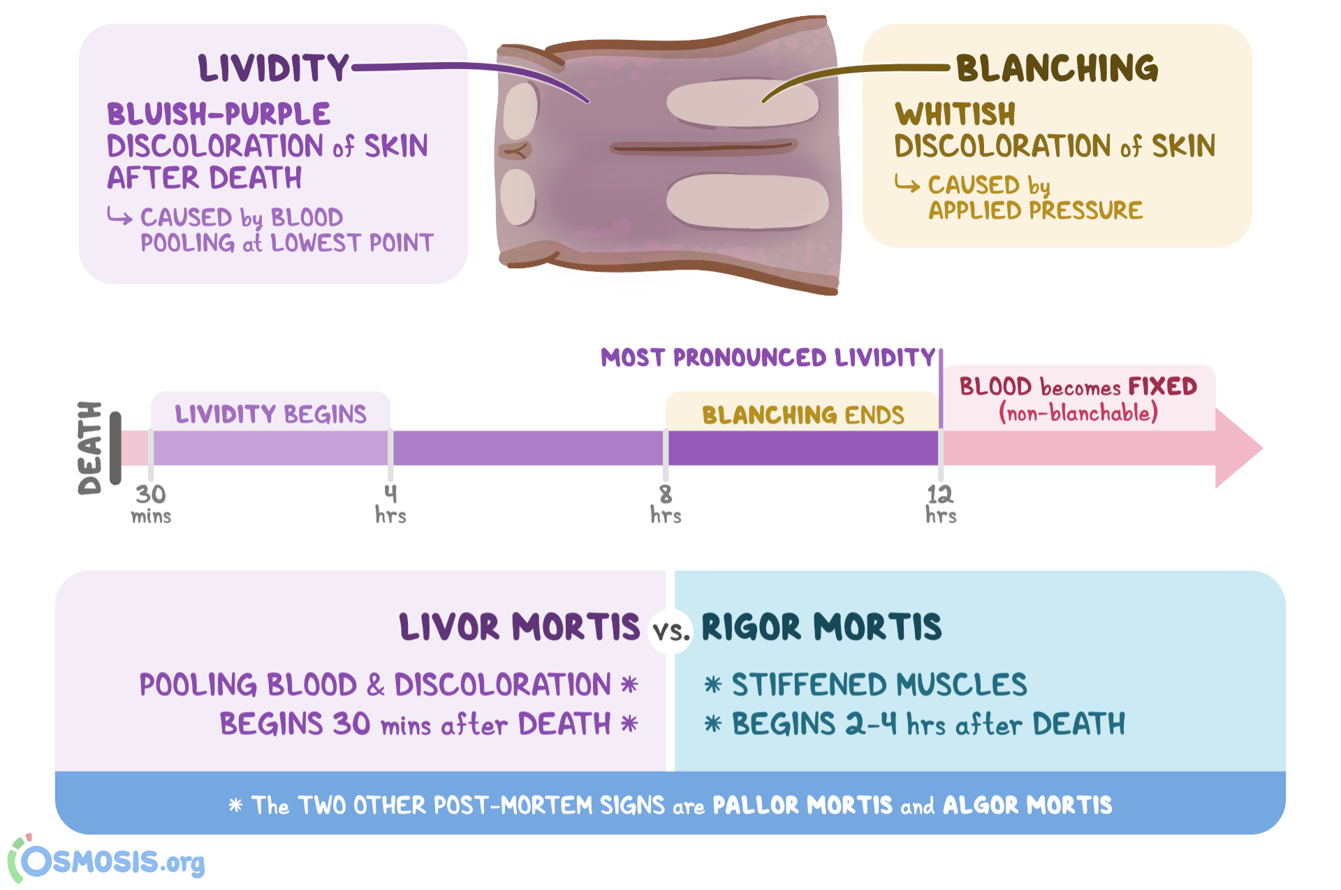 image-result-for-rigor-mortis-stages-rigor-mortis-rigor-criminology