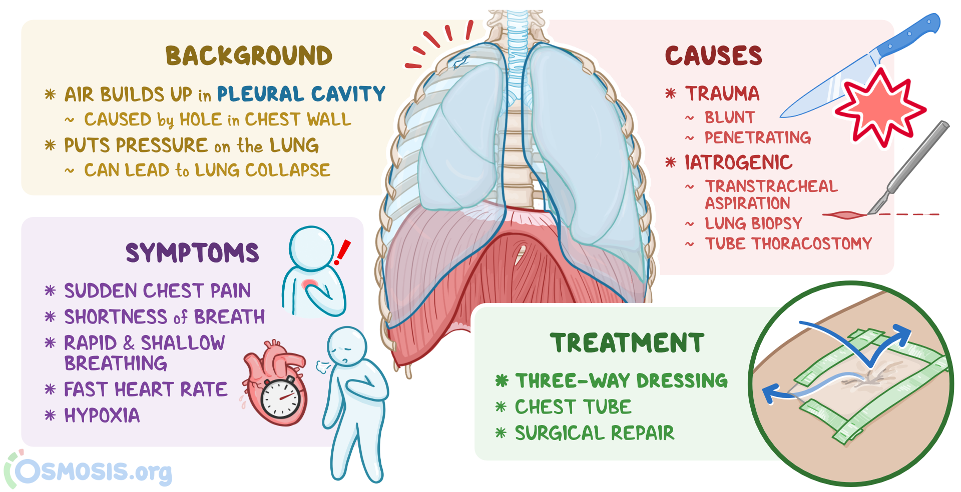 Pneumothorax Symptoms Causes Diagnosis And Treatment FUPH Pneumothorax Symptoms Causes Diagnosis And Treatment FUPH