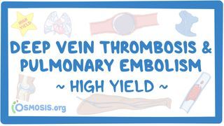 Video poster for High Yield: Deep vein thrombosis and pulmonary embolism