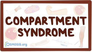Video poster for Compartment syndrome
