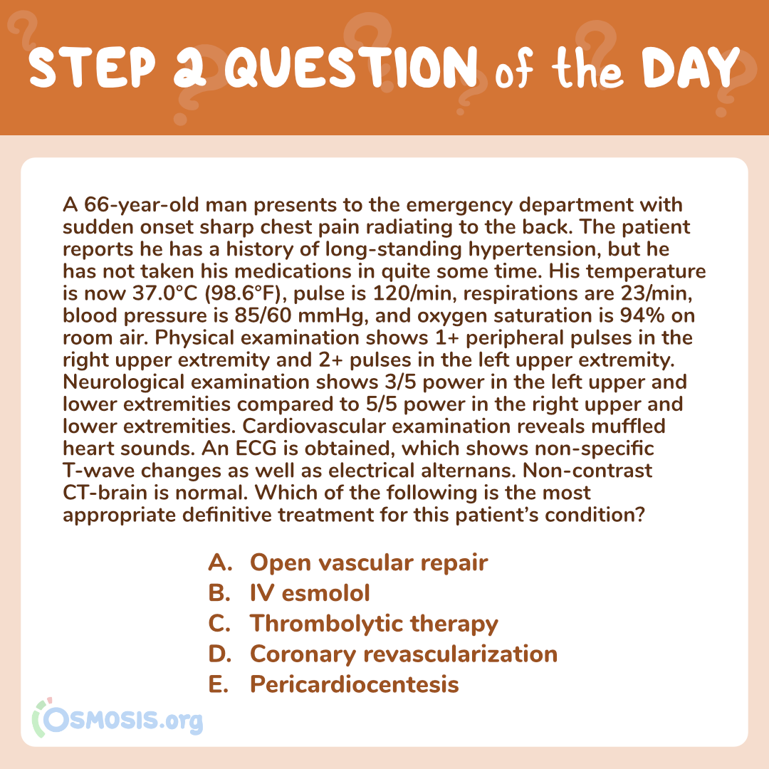 Study Tips USMLE® Step 2 CK Question of the Day Chest Pain