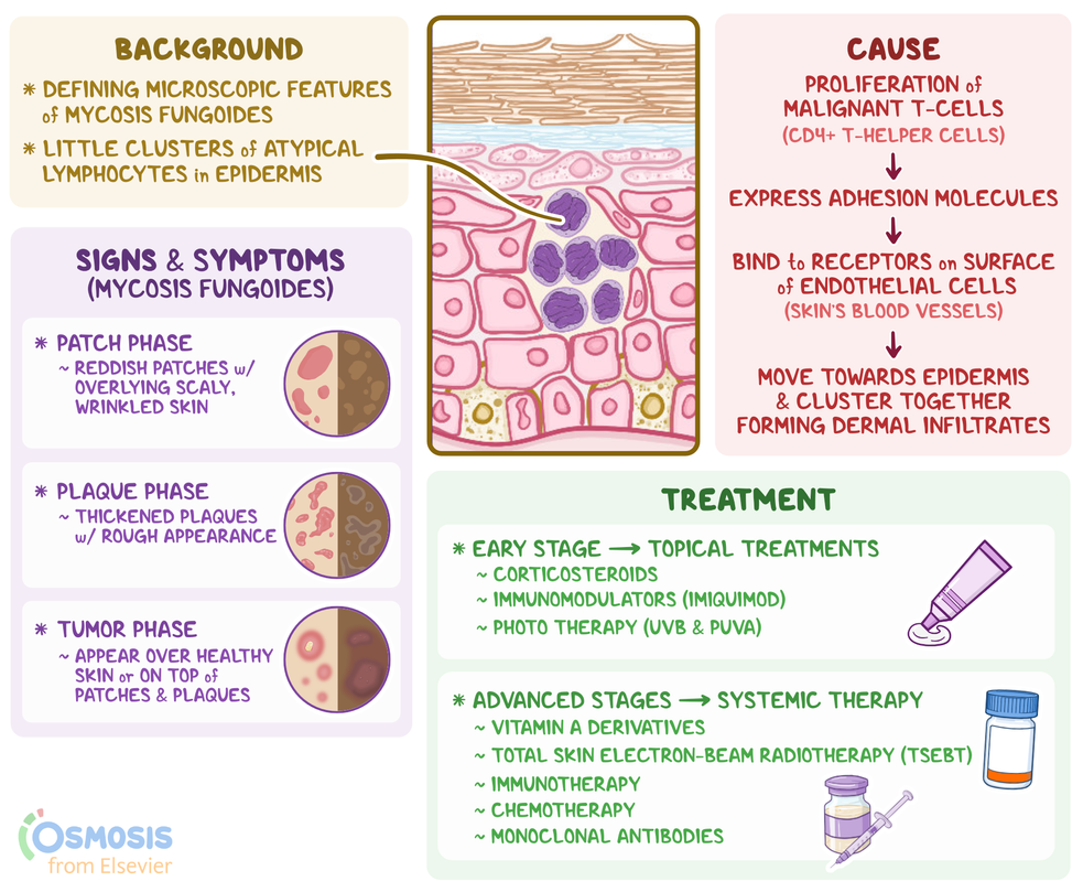 Pautrier Microabscesses: What Are They, Diagnosis, and More | Osmosis