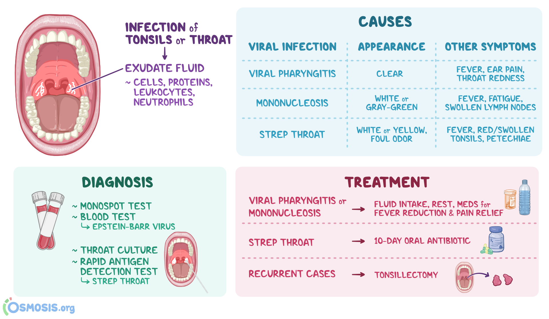 Tonsillar Exudate White Patches Causes Infections Osmosis Tonsillar Exudate White Patches Causes Infections Osmosis