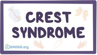 Video poster for CREST syndrome