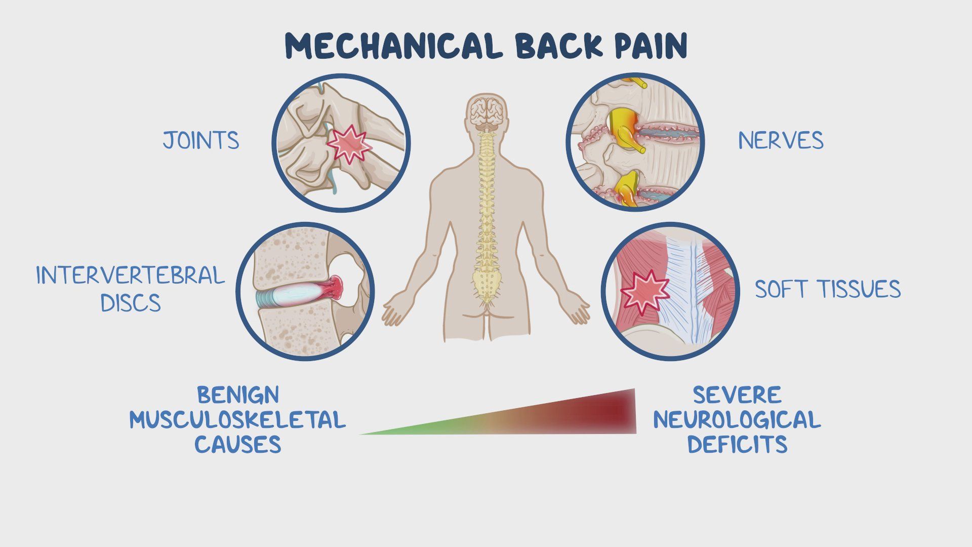 Video mechanical back pain clinical sciences