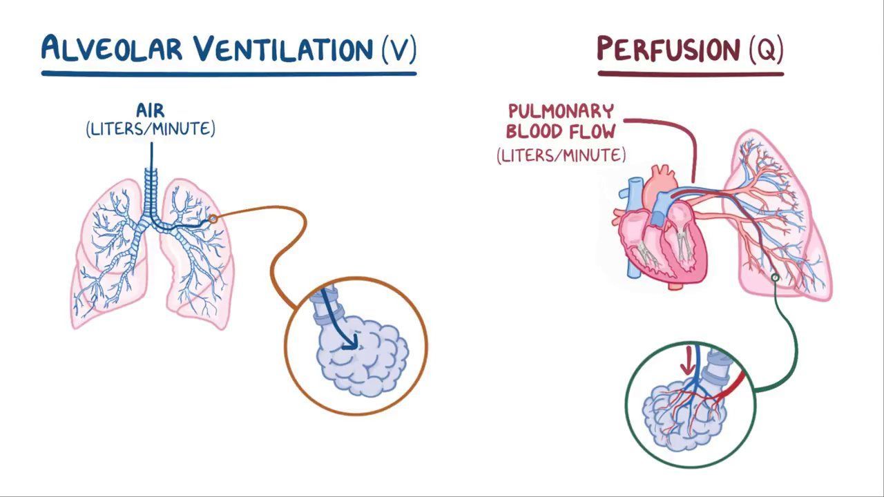 Ventilation Perfusion Ratios And V Q Mismatch Osmosis