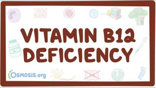 Video poster for Vitamin B12 deficiency