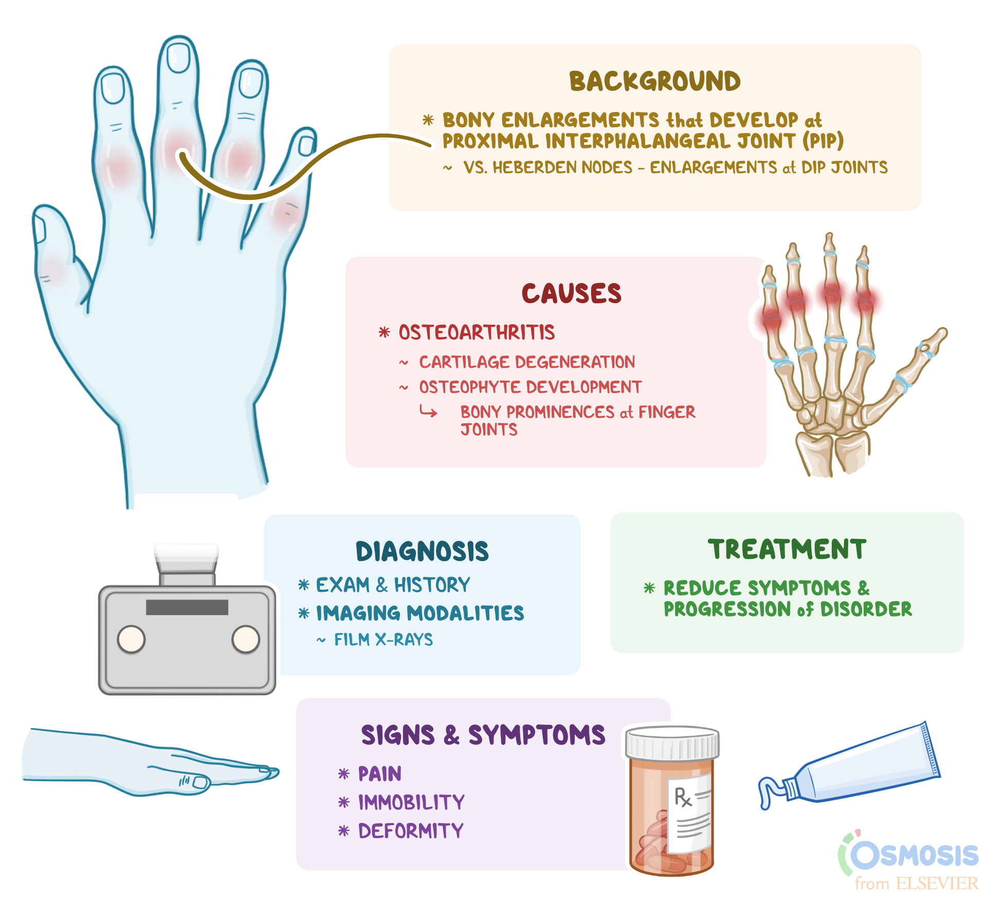 Bouchard Nodes What Are They Causes Signs Symptoms And More Osmosis