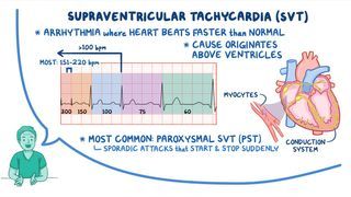 EPSとSVT Arrhythmias - Supraventricular tachycardia (SVT) | Osmosis