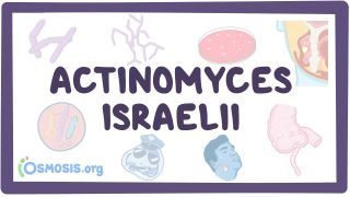 Video poster for Actinomyces israelii