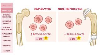 Intrinsic hemolytic normocytic anemia: Pathology review