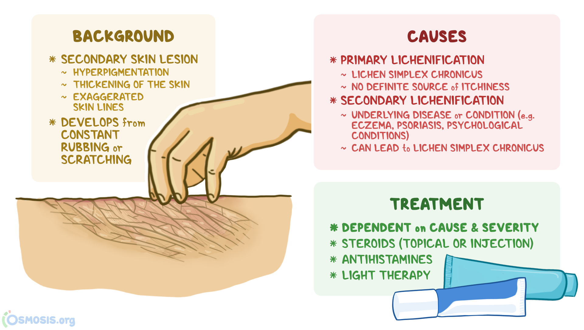 Lichenification What Is It, Causes, Diagnosis, Treatment, and More