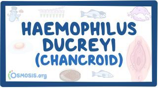 Video poster for Haemophilus ducreyi (Chancroid)