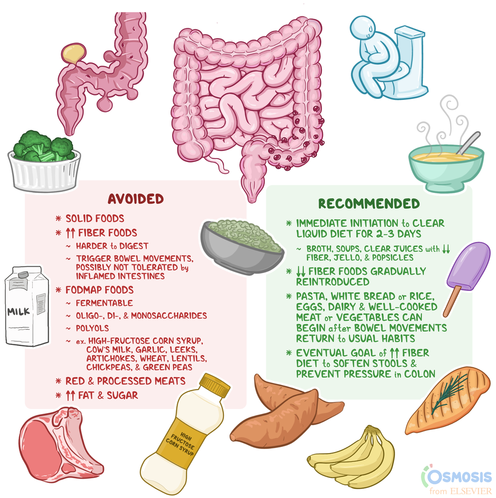 diverticulitis and foods to avoid