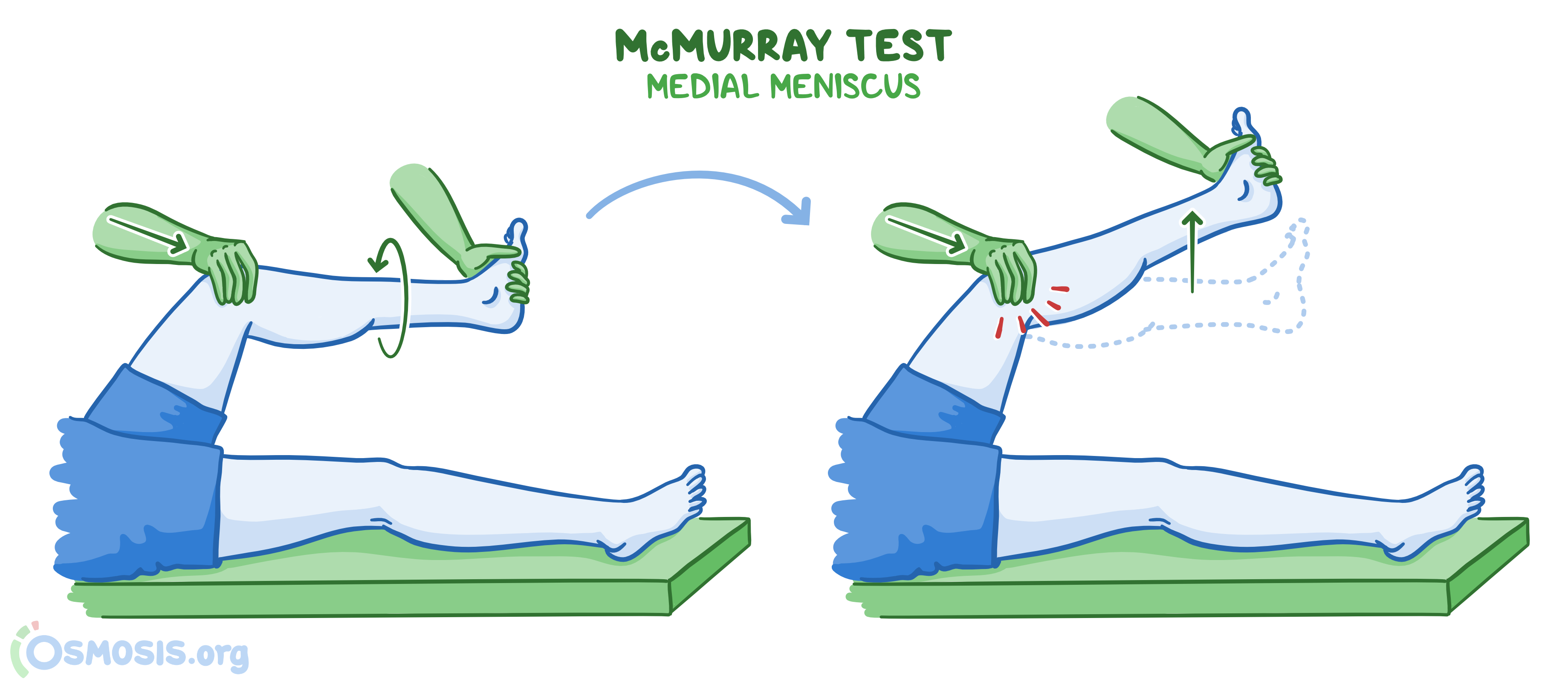 Special Tests For The Lower Limb Osmosis