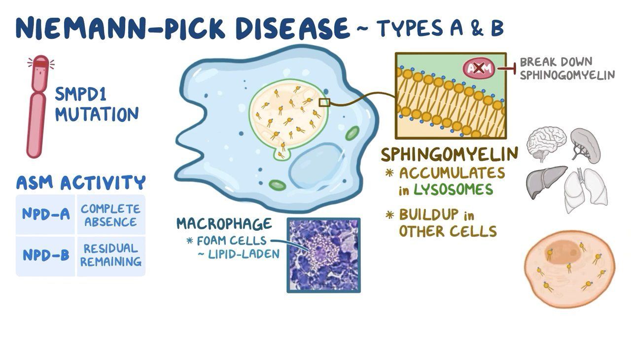 Niemann Pick Pdf Niemann Pick Disease Type C Analysis Of 7 Patients 