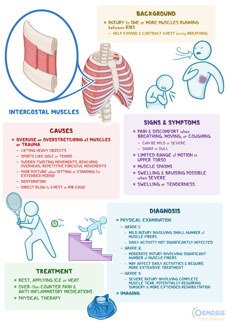 Intercostal Muscle Strain What Is It Causes Signs Symptoms And 