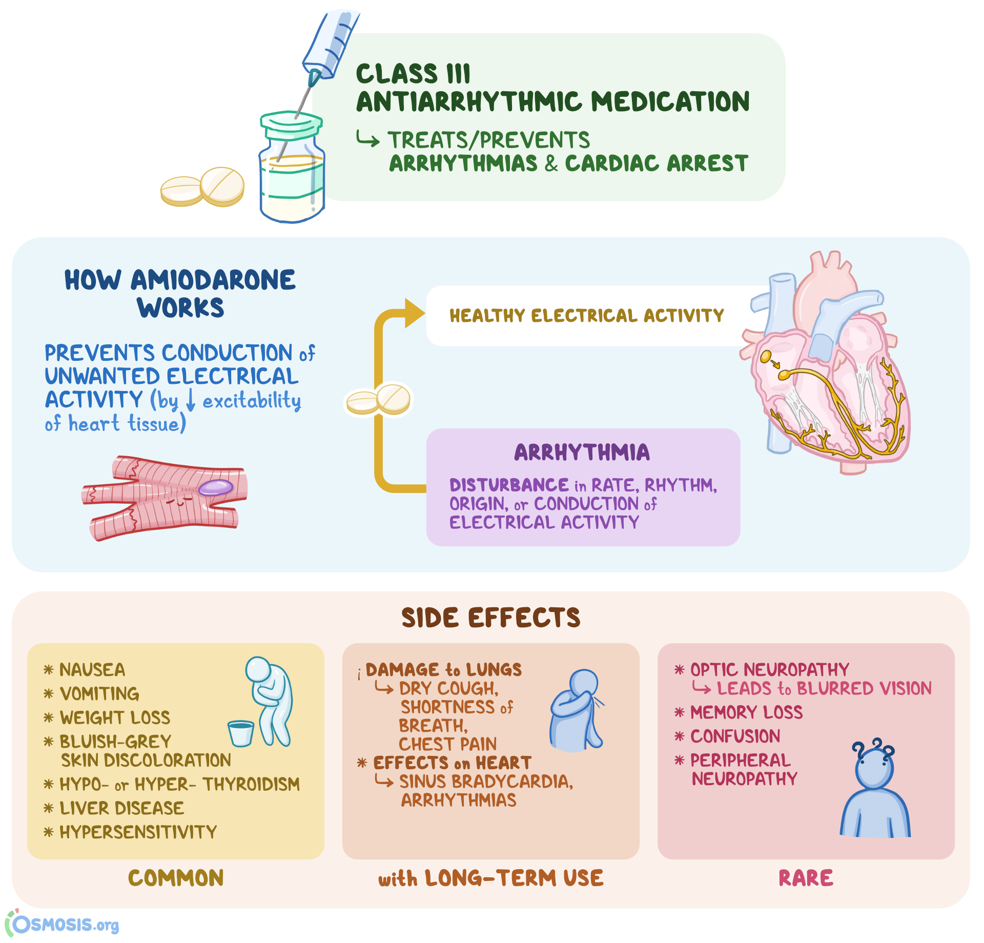 Amiodarone What Is It How Does It Work What Is It Used For Osmosis