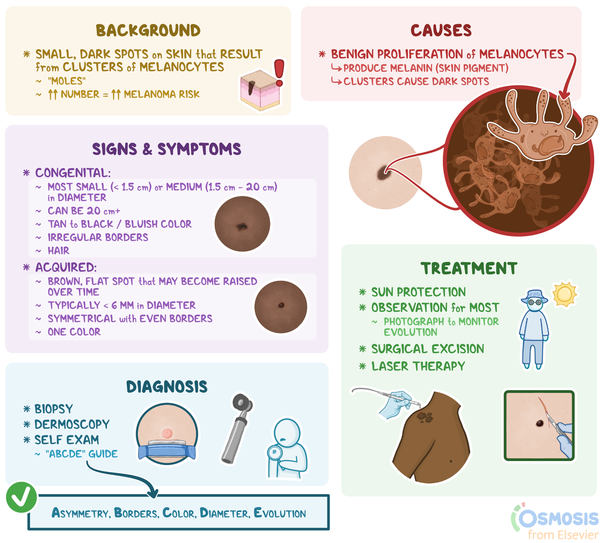 Melanocytic Nevus: What Is It, Causes, Signs and Symptoms, and More ...